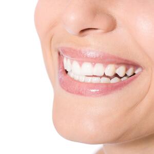 VRATITE LEPOTU SVOM OSMEHU: Na ovaj praktičan i efikasan način ponovo možete imati bele zube!