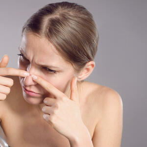 Imate problematičnu kožu lica? Uz pomoć OVOGA ćete se otarasiti akni, mitisera i ostalih nepravilnosti!