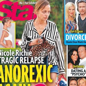 Nikol Riči ponovo u borbi sa anoreksijom
