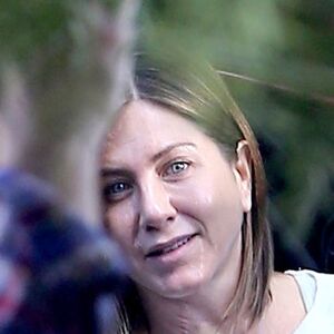 Ožiljci na licu Dženifer Aniston