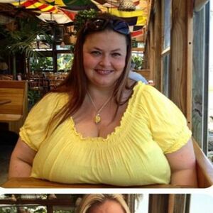 Smršala 75 kilograma da bi mogla da živi: Količina holesterola toliko velika da joj je pretio infarkt (FOTO)