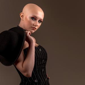Ponosna tinejdžerka ne dozvoljava da joj alopecija utiče na život: Ako ne želim da nosim periku, neću je nositi! (FOTO)
