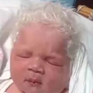 Ova beba je rođena SEDA: Evo zašto je ovaj video obišao svet i šokirao lekare (VIDEO)