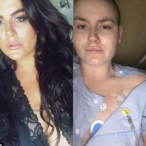 Mlada blogerka podelila potresne fotografije snimljene tokom najteže borbe: Ovo je podsetnik da rak ne bira!