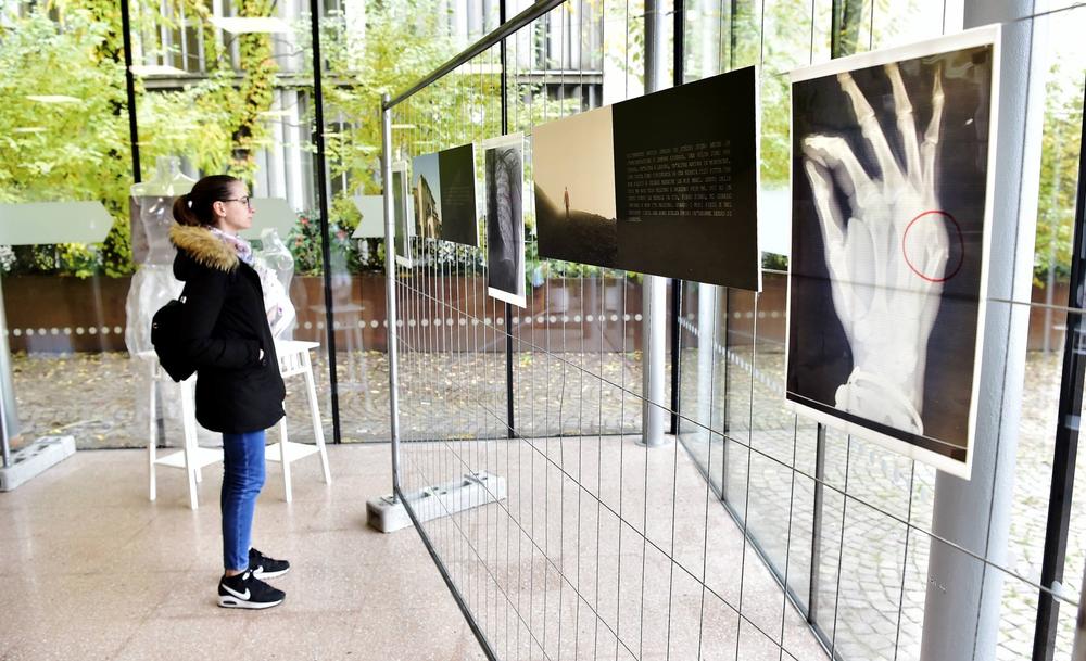 <p>Povodom Međunarodnog dana borbe protiv nasilja nad ženama koji se obeležava danas, bolnica u Milanu izložila je rendgenske snimke žrtava porodičnog nasilja.</p>