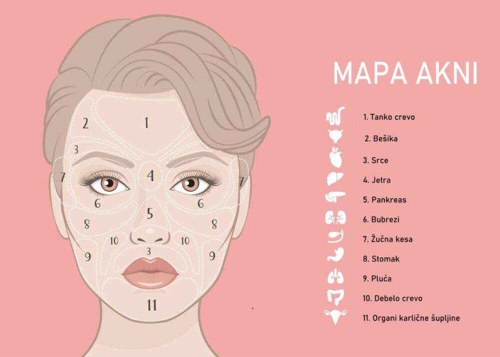 Mapa akni, Mapa lica