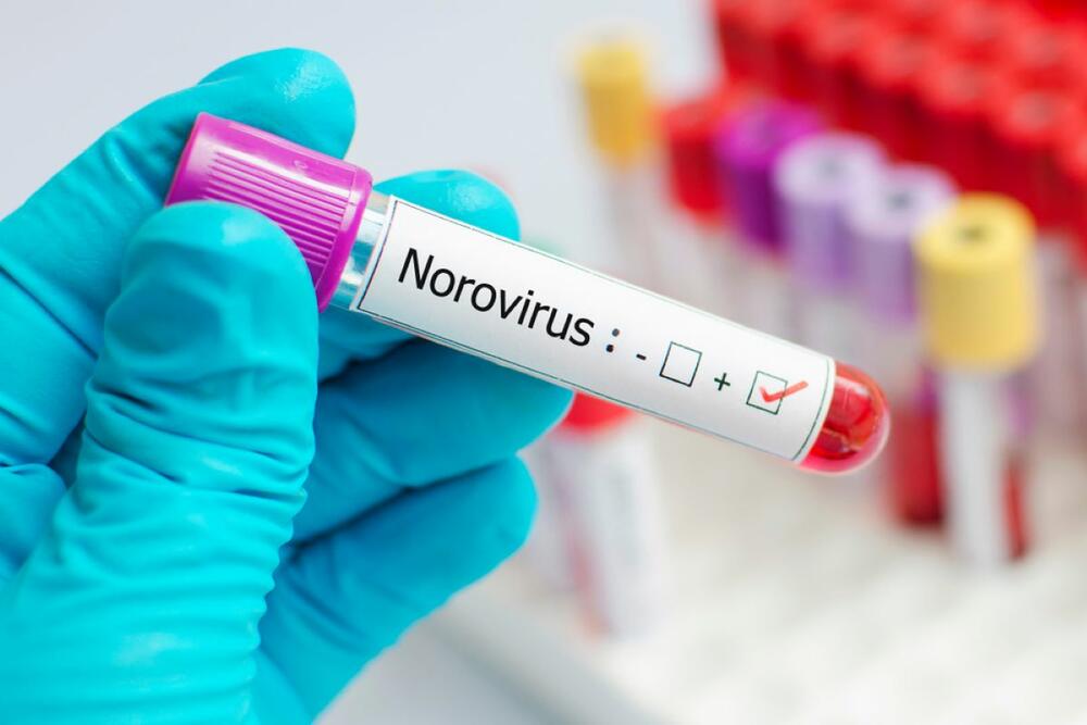 Šta je norovirus i koji su njegovi simptomi?