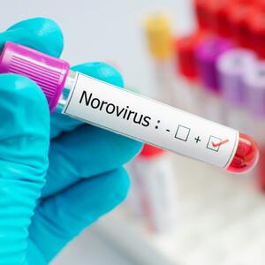 Počinje naglo i vrlo lako se širi: Šta je NOROVIRUS i koji su njegovi simptomi?