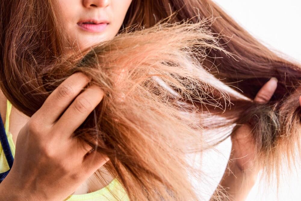 Suva kosa spada u simptome anemije izazvane manjkom gvožđa