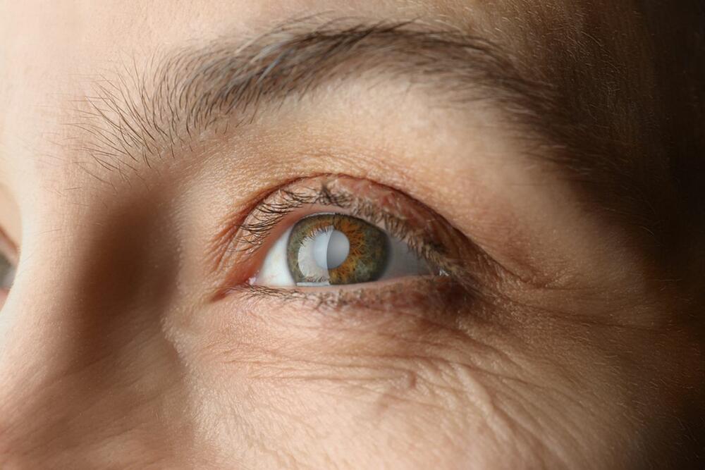 Simptomi glaukoma zavise od njegove vrste