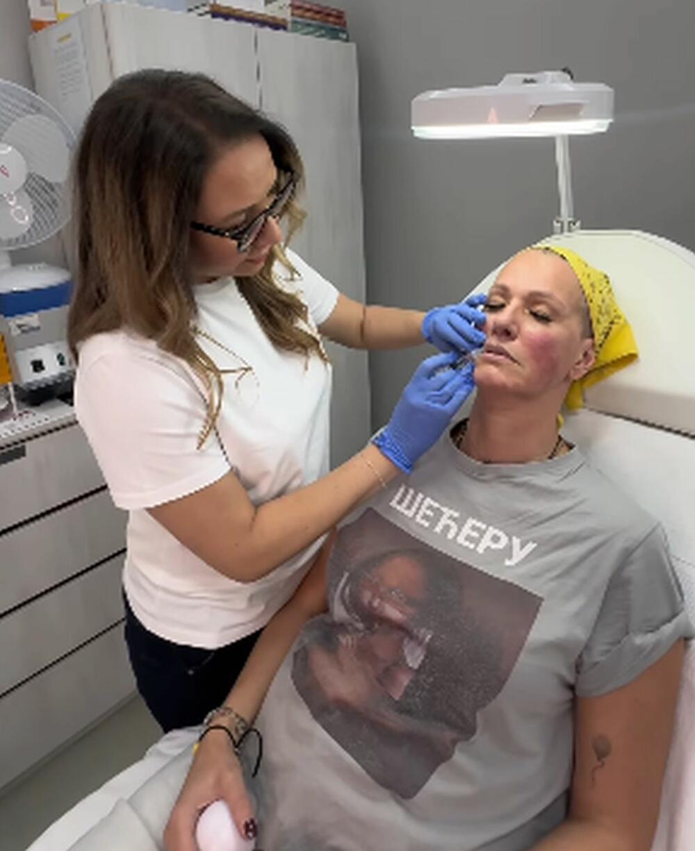 Tijana Dapčević na tretmanu za lice i ubrizgavanju hijaluronskih filera u usne