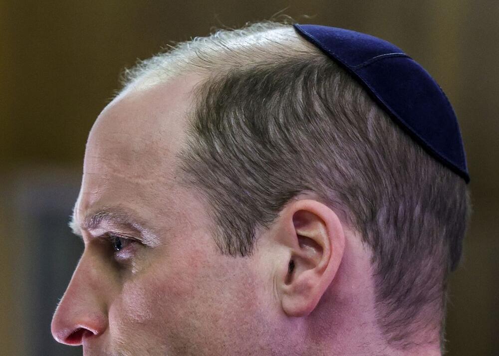 Princ Vilijam od Velsa je tokom posete sinagogi navodno ima modrice