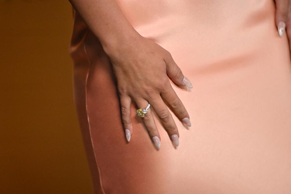 Detalj na glumici Mili Bobi Braun na dodeli SAG nagrada 2025.