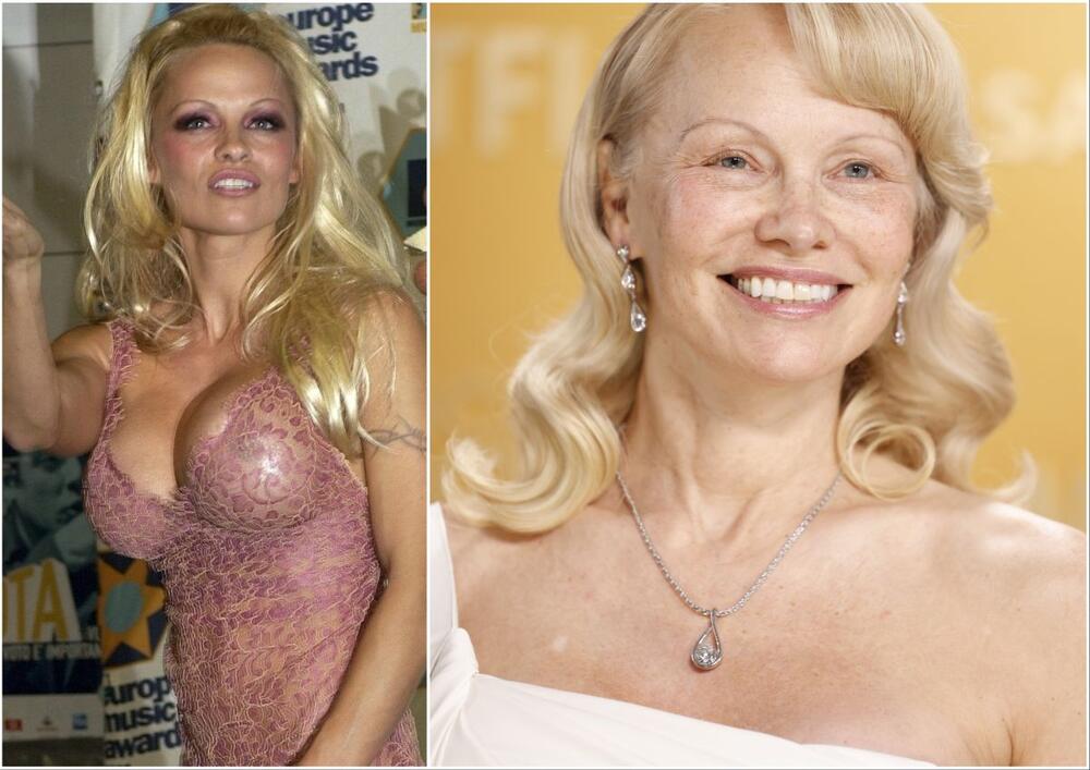 Pamela Anderson, prelepa i nekad i sad