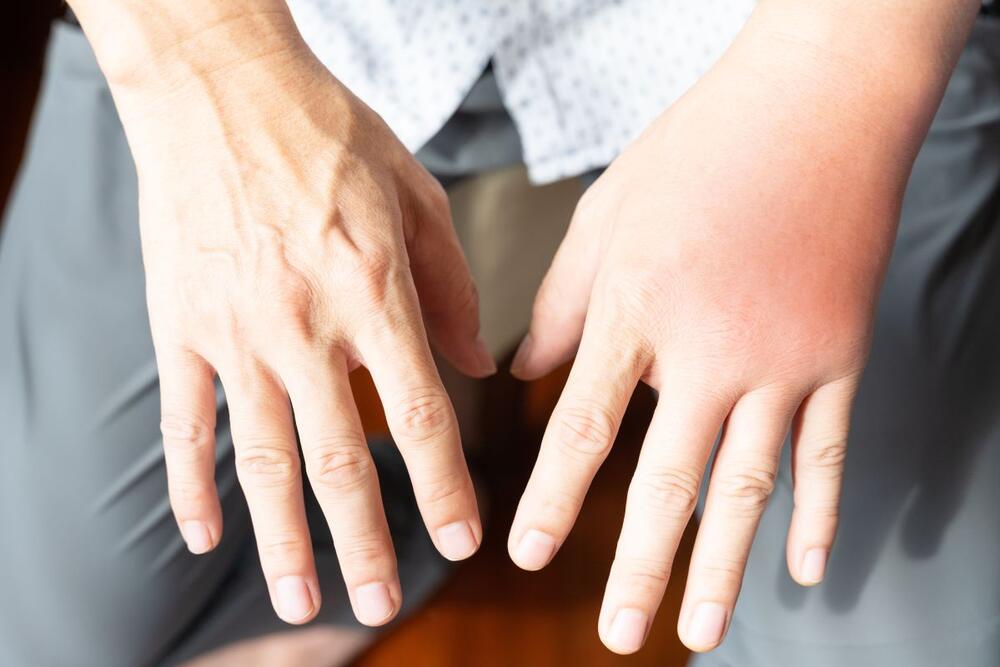 Kada osetite jače simptome, javite se lekaru