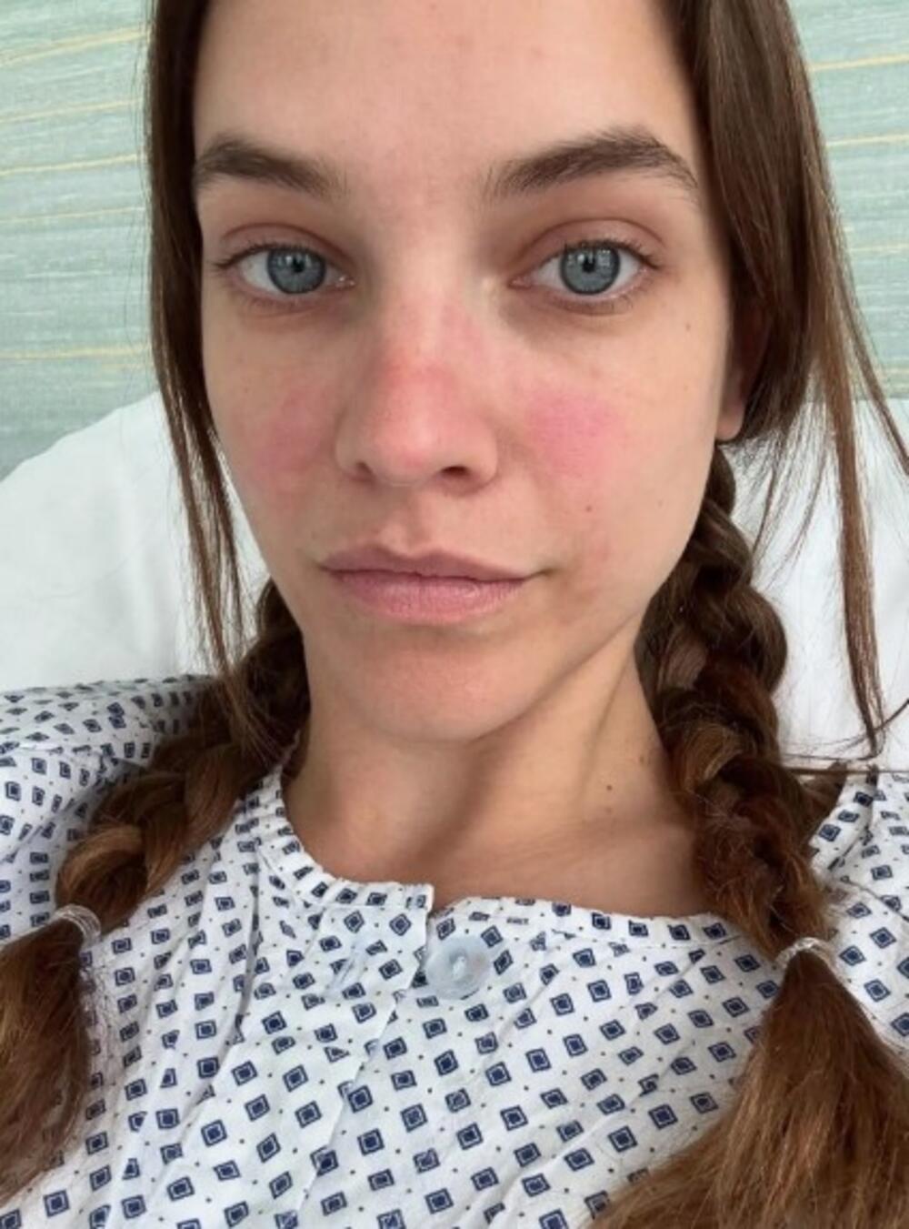 Barbara Palvin u bolnici, posle operacije zbog endometrioze