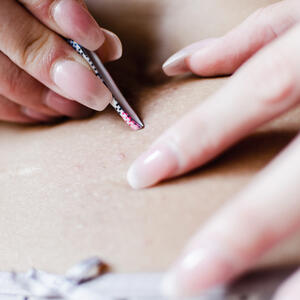 Urasle dlake su često veći problem nego što mislite: Sredstvo od 2 sastojka koje sigurno imate u kuhinji može da pomogne