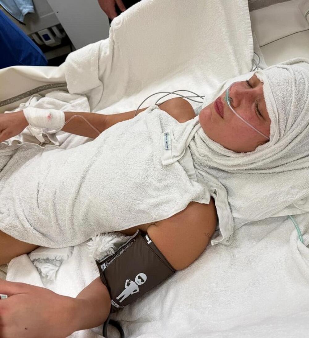 Bela Hadid u bolnici zbog 'hronične lajmske bolesti'