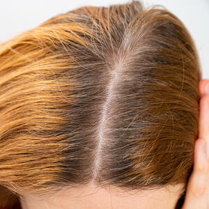 Kako prekriti izrastak bez farbanja? 6 superbrzih trikova koji uvek deluju