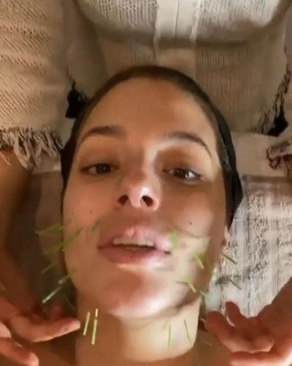 Ešli Grejem redovno ide na akupunkturu