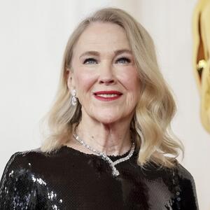 Od čega je umrla Ketrin O'Hara? Rođena je kao fenomen, s vrlo retkim poremećajem, ali izgleda da joj nije on presudio