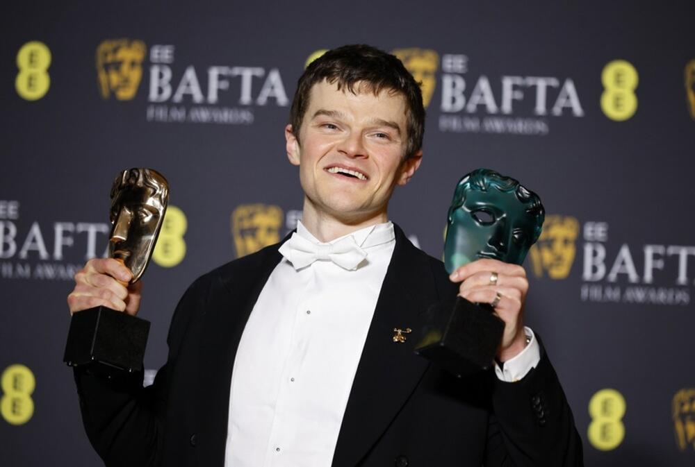Robert Aramajo dobio je BAFTA nagradu za najboljeg glumca u filmu 'I swear'