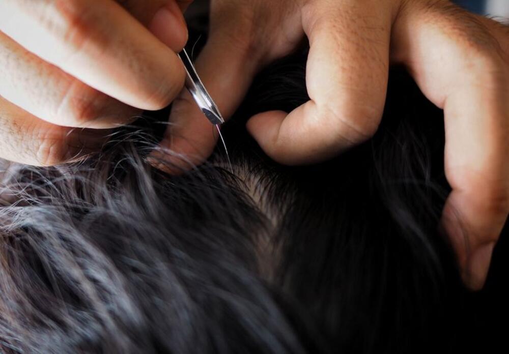 Je li čupanje sedih vlasi dobra ideja ili ne, često je pitanje na internetu