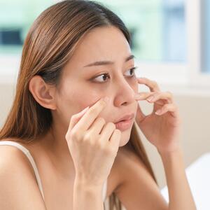 Kako da uklonite umor sa lica? Saveti koji će učiniti da i posle neprospavane noći izgledate sveže i odmorno