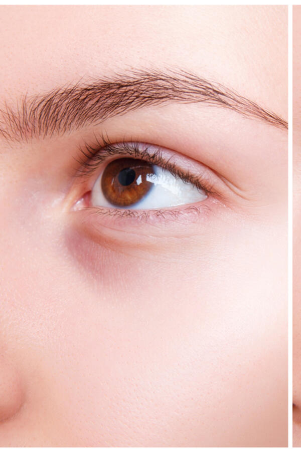 Zbogom podočnjacima i tamnim kolutovima za 30 sekundi! Šminkerski trikovi koje svako može da izvede i uvek deluju