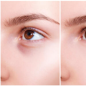 Zbogom podočnjacima i tamnim kolutovima za 30 sekundi! Šminkerski trikovi koje svako može da izvede i uvek deluju