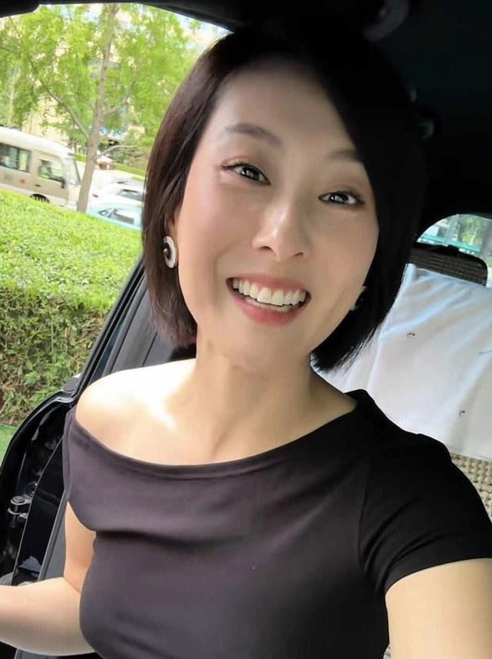 Kineska glumica Guo Tong se podvrgla tretmanima koji imaju za cilj da joj vrate prirodni pigment kose