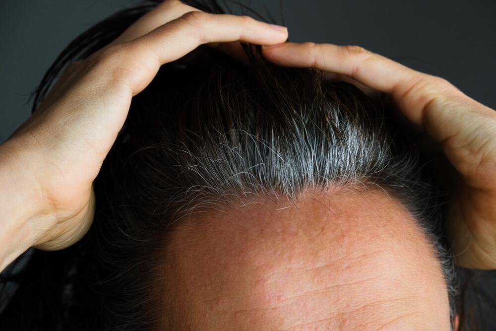 Broj melanocita kojim se folikul kose puni svakim novim ciklusom rasta kose sve je manji, zbog čega je normalno da kosa vremenom osedi.