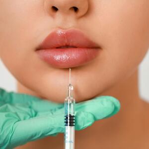 Sve što ste hteli da znate o povećanju usana filerima: Da li je bolno, koliko košta, kako se spremiti?