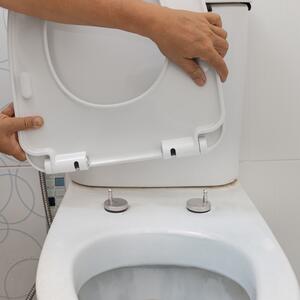 Da li WC daska ima rok trajanja? 7 znakova da je vreme da iako je čitava treba da kupite novu