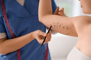 Nervira vas opuštena koža na rukama? Plastični hirurg otkrio šta sve treba znati o operaciji viška kože (brahioplastici)