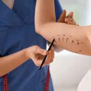 Nervira vas opuštena koža na rukama? Plastični hirurg otkrio šta sve treba znati o operaciji viška kože (brahioplastici)