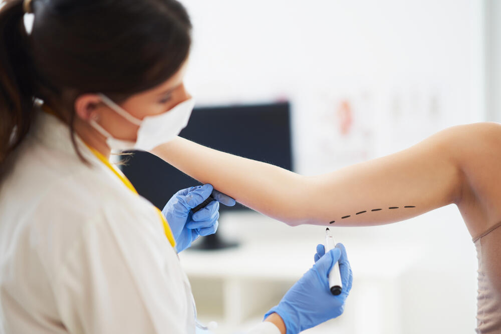 VIŠAK KOŽE NEKAD JE NEMOGUĆE UKLONITI DRUGAČIJE OSIM OPERACIJOM 